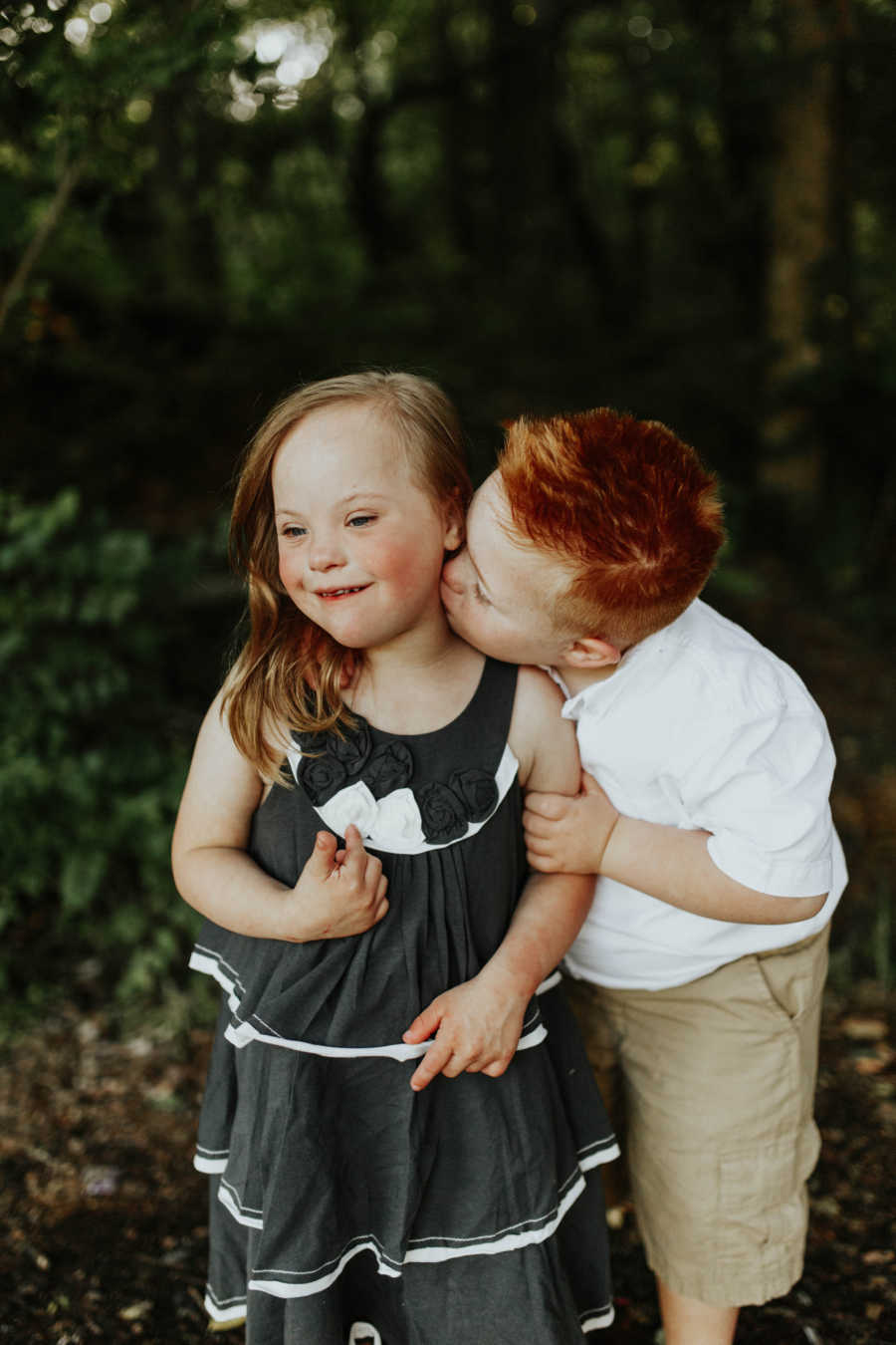 Image result for Down syndrome