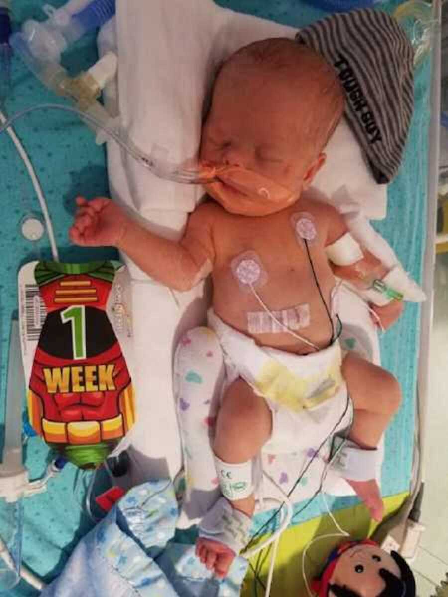 baby laying in NICU next to "1 week" sign