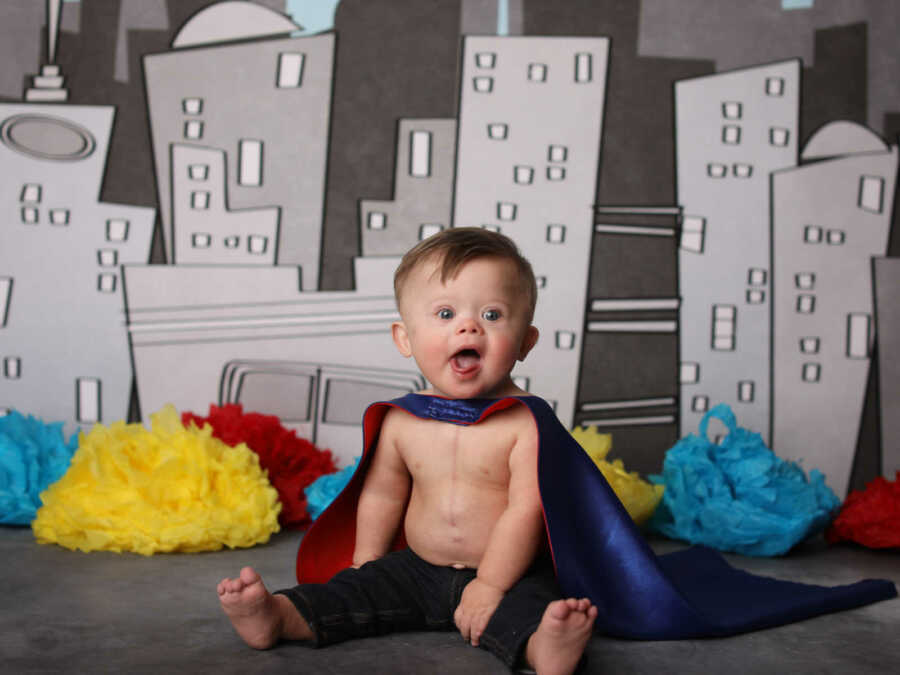 baby with down syndrome in superhero cape