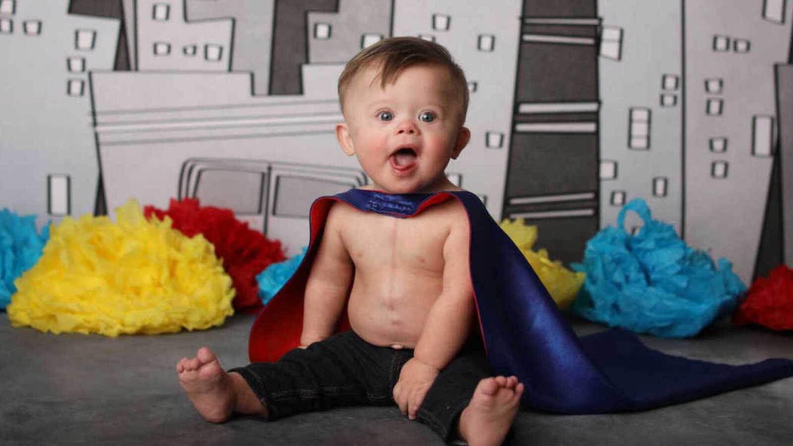 baby with down syndrome wearing superhero cape