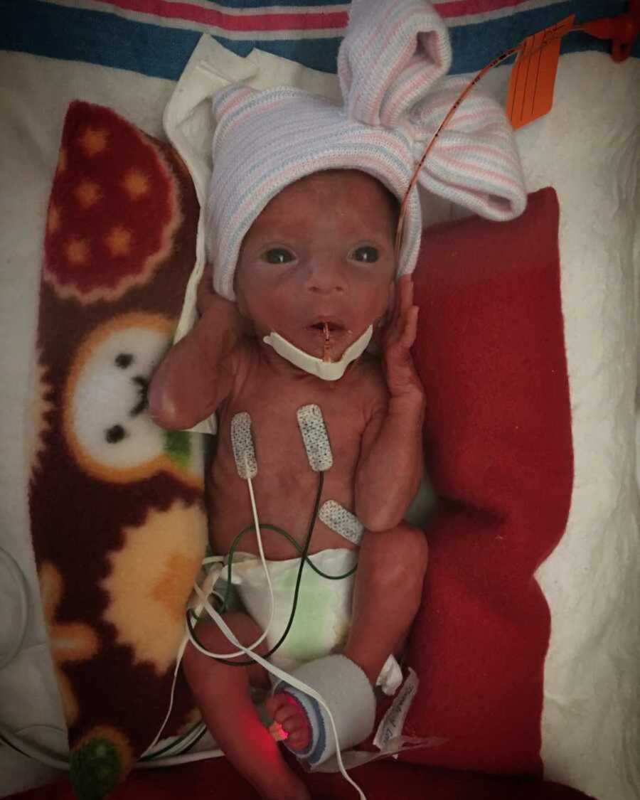 Premature baby girl with pink beanie lying on her back with wires attached to her body