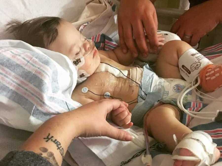toddler laying in hospital bed after heart surgery