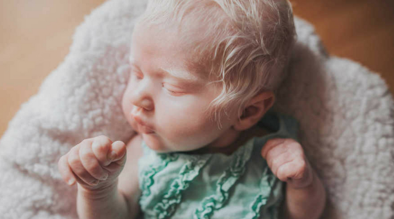 ‘our Baby Had A Head Full Of Hair — White As Snow Moms Shocked