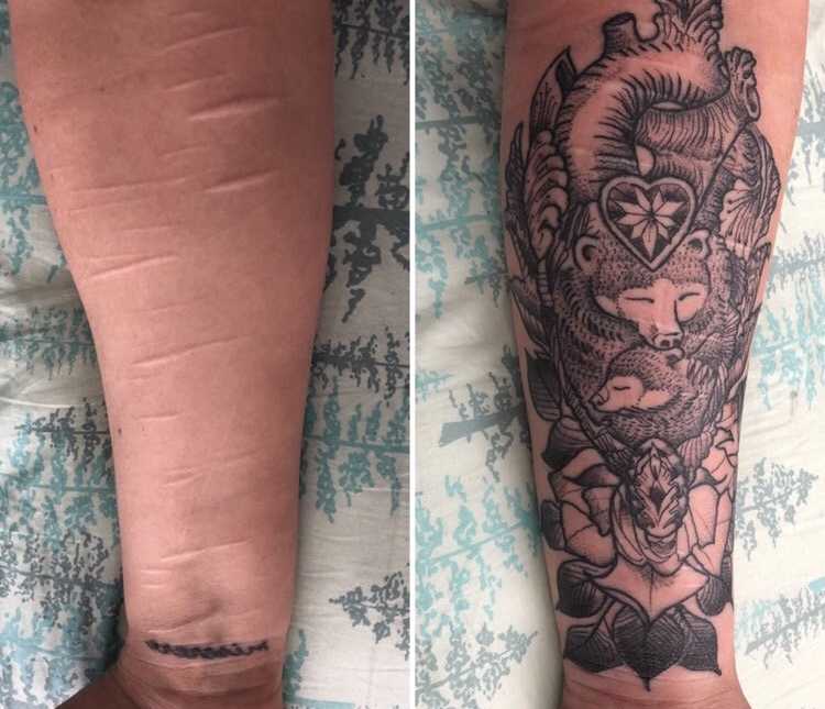 I Replaced Self Hate With Pure Love Woman Covers Inflicted Scars Mama Bear Tattoo For Her Autistic Son What Matters I Replaced Self Hate With Pure Love Woman Covers Inflicted Scars Mama Bear Tattoo For Her Autistic Son What Matters