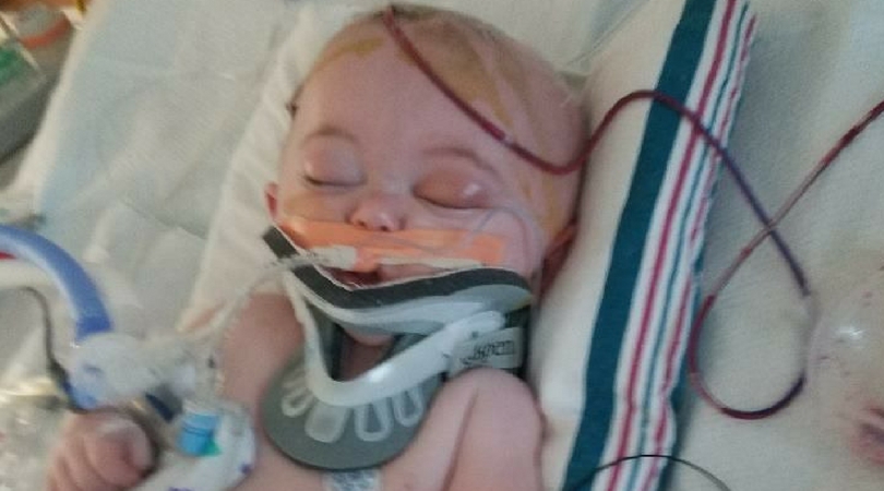 6 month old in hospital bed with neck brace after rolling off bed