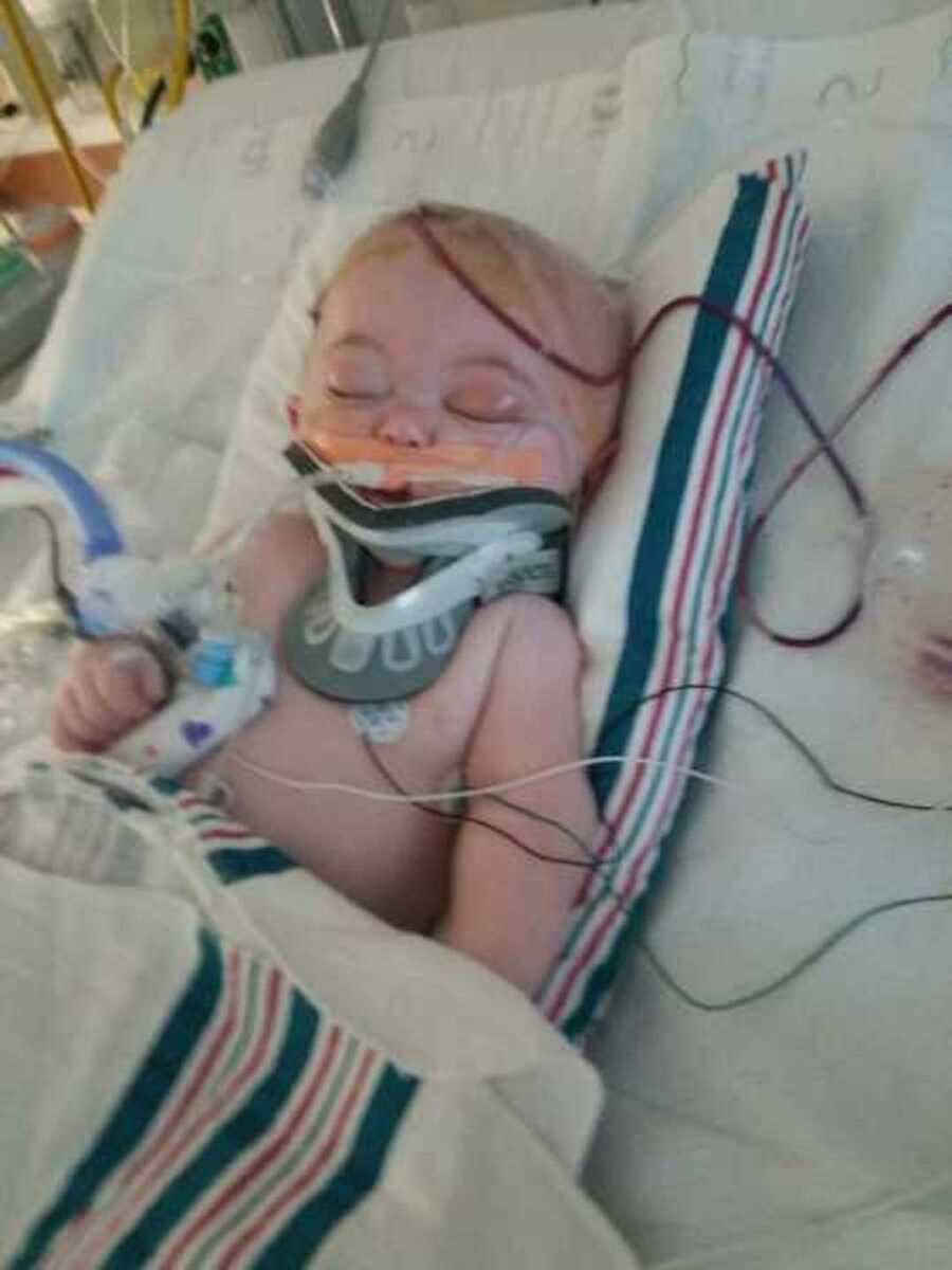 6 month old in hospital bed with neck brace after rolling off bed