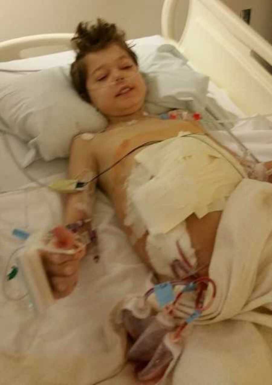 boy with cystic fibrosis after undergoing a liver transplant