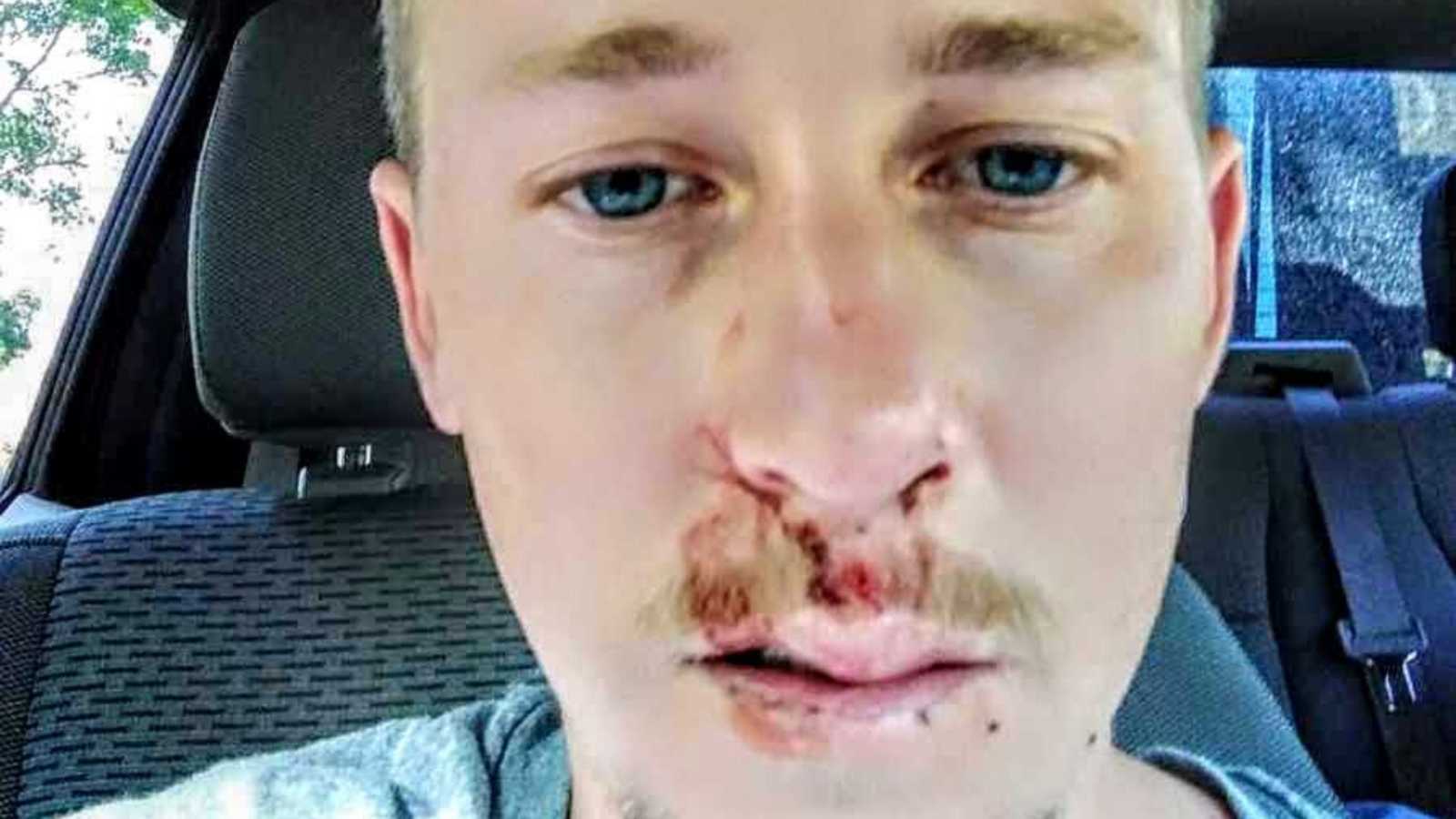 man takes selfie in car with face injury after going into bodily shock from cold water