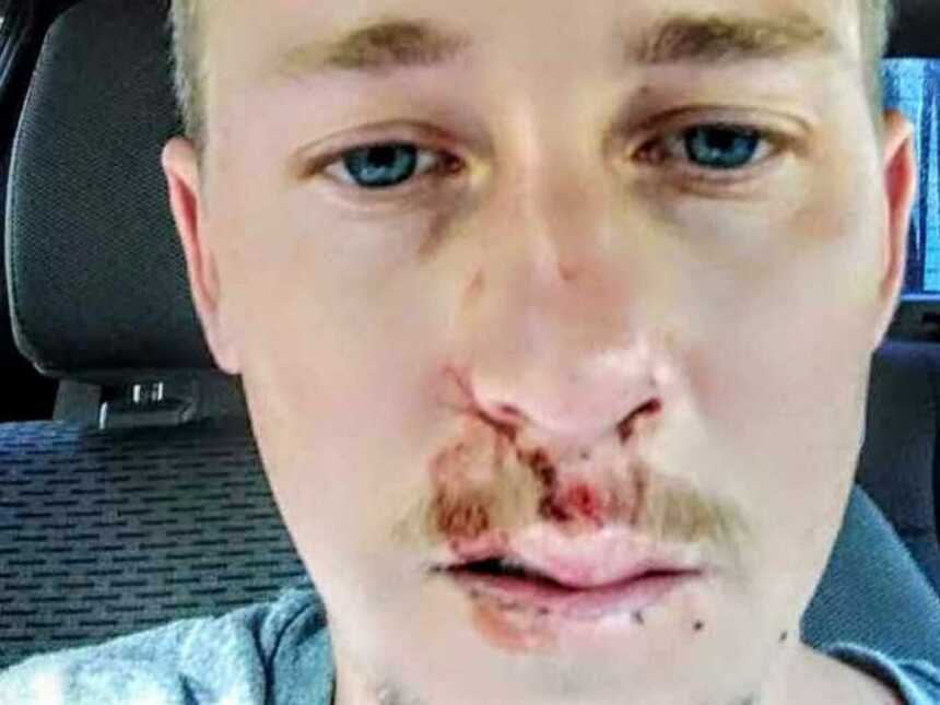 man takes selfie in car with face injury after going into bodily shock from cold water