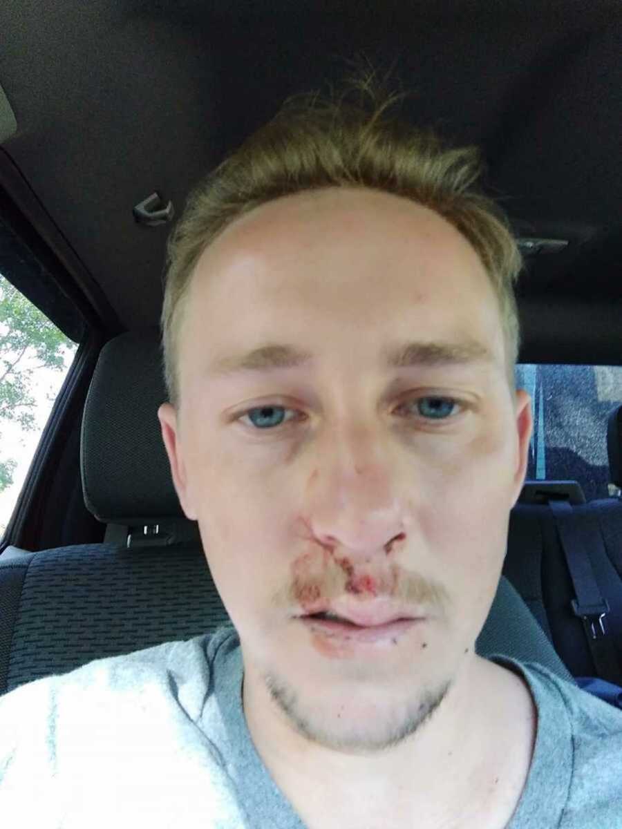 man takes selfie in car with face injury after going into bodily shock from cold water