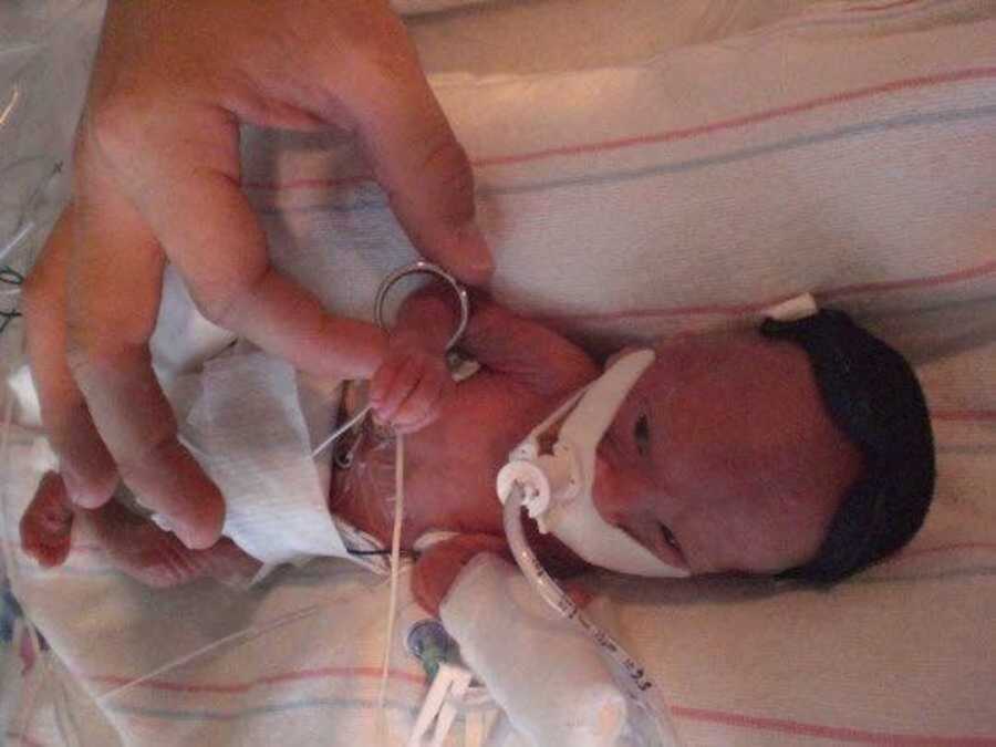 preemie baby with person holding ring around the baby's arm