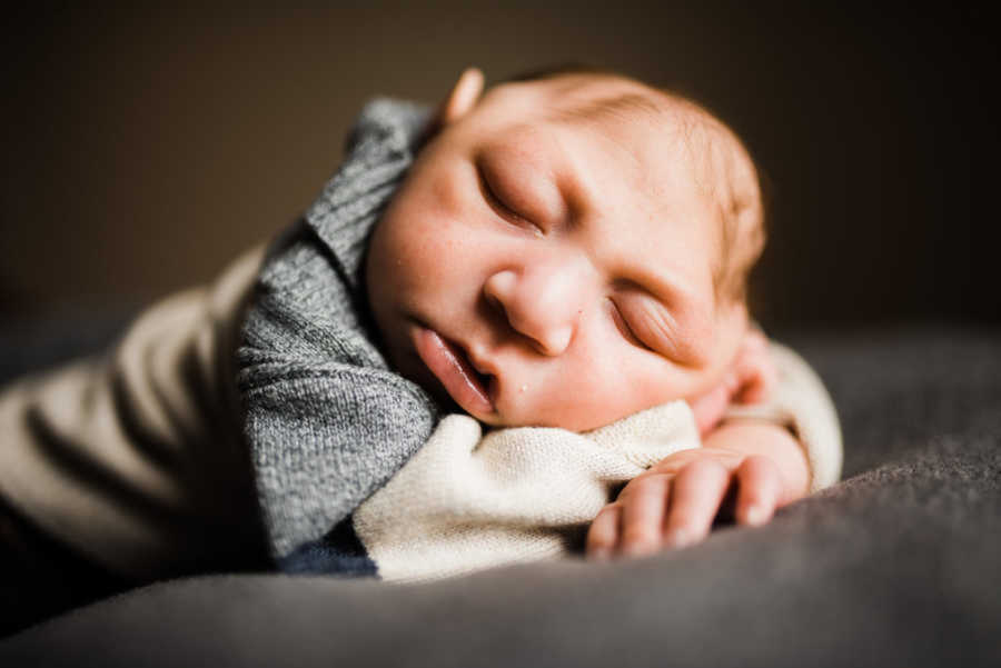 Newborn with microcephaly sleeping