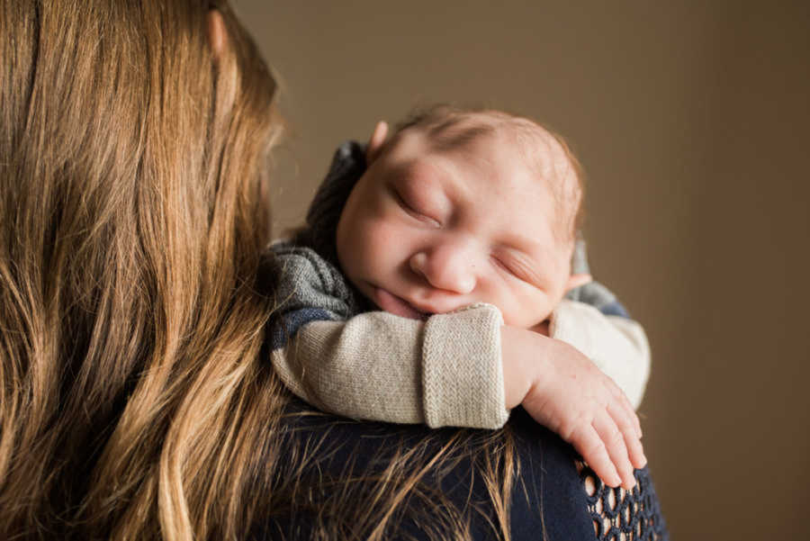 Newborn with microcephaly napping on mom's shoulders