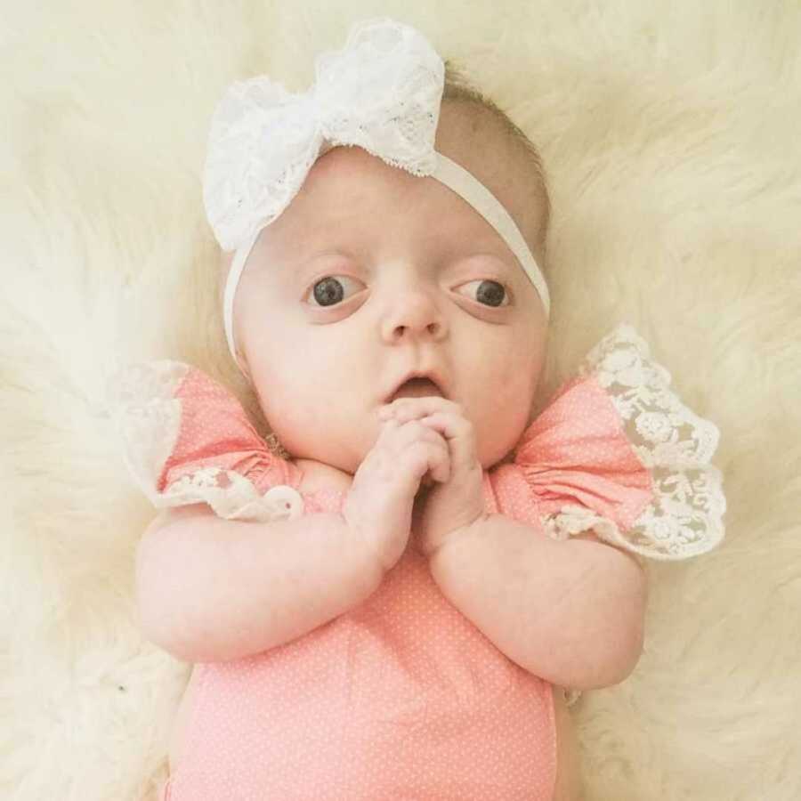 Baby with Pfeiffer Syndrome holding hands together above her face in pink onesie with lace headband 