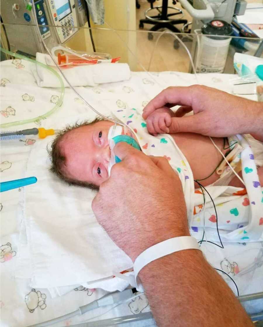 dad holds the hands of baby with pfeiffer syndrome