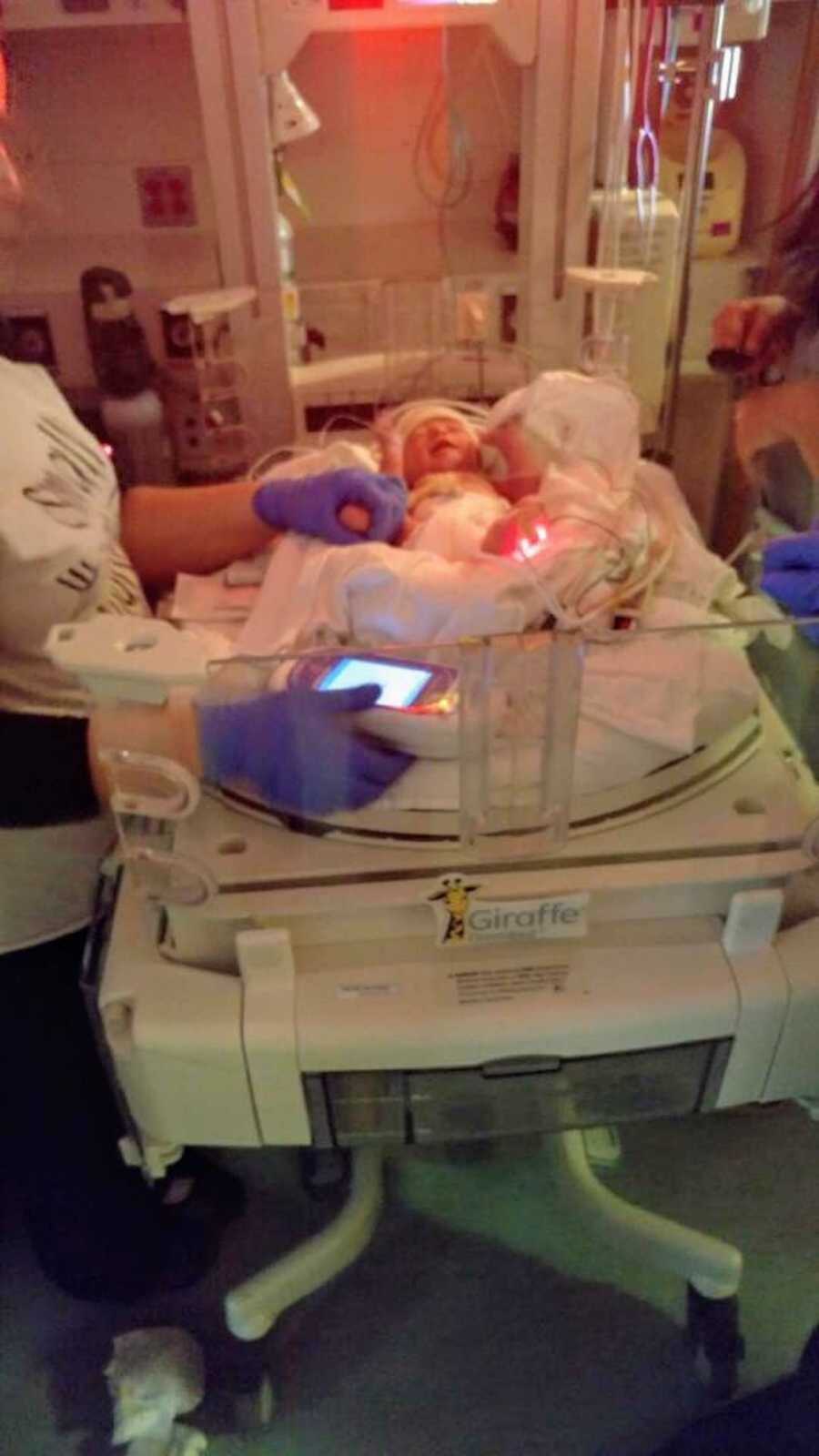 Newborn lays in NICU with nurses monitoring him