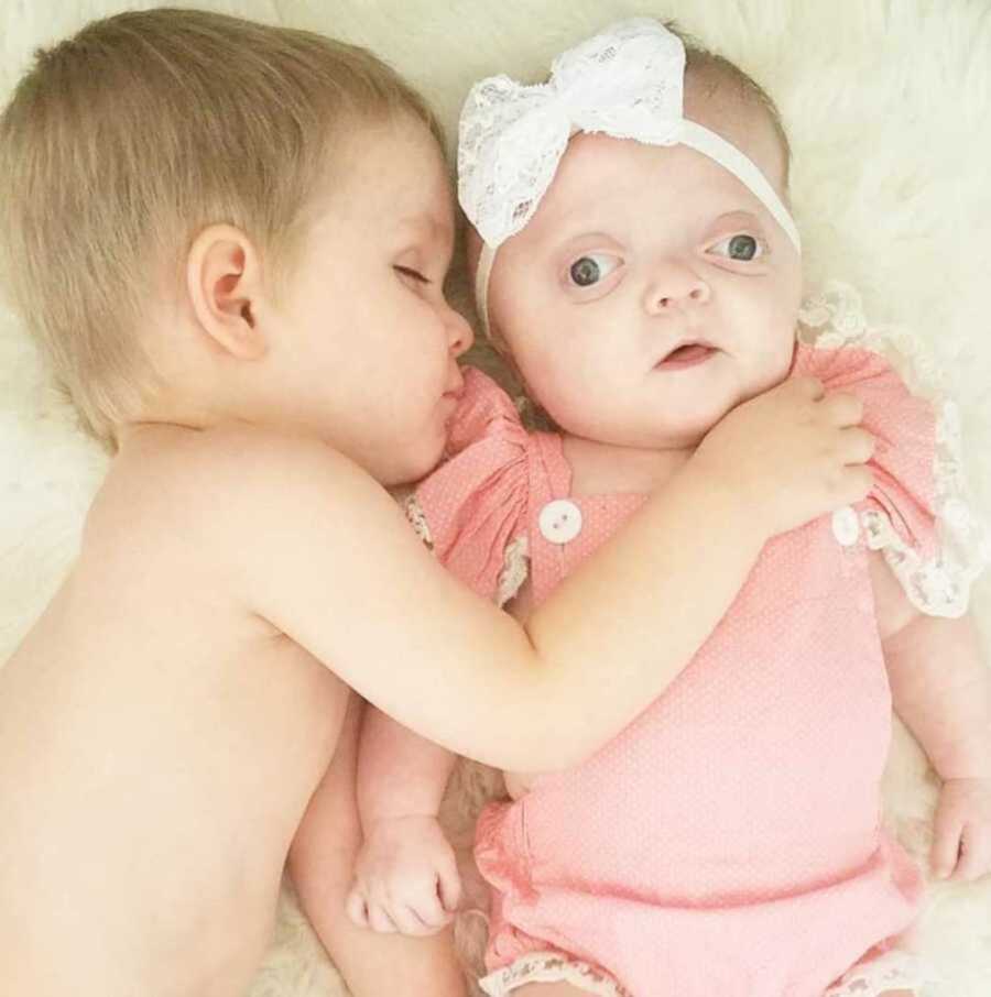 Little boy lays on ground asleep hugging little sister with Pfeiffer Syndrome