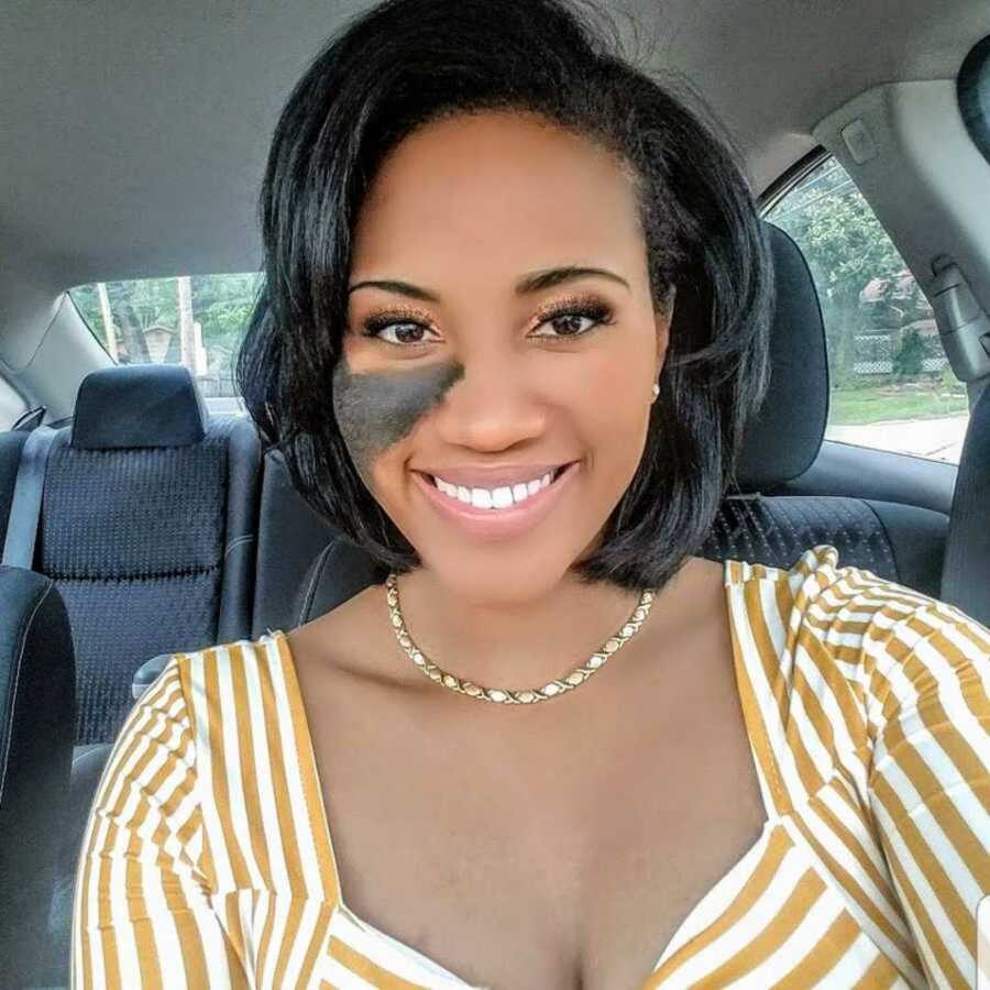 Woman with nevus birthmark smiling inside car with yellow striped shirt