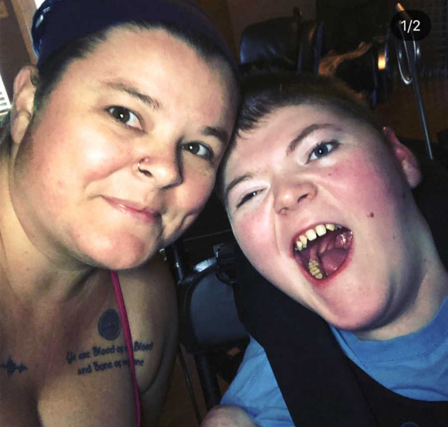 Mom and disabled child taking photo together 
