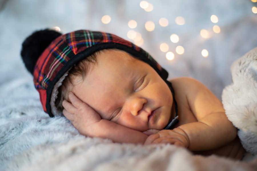 baby with down syndrome wearing red hat