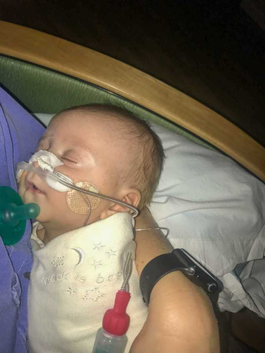 baby with oxygen tube in bed