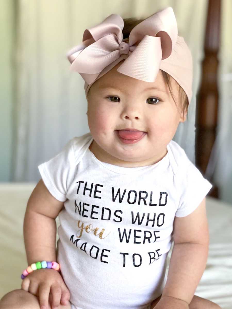 Woman gives birth to a highrisk child with Down syndrome; 'She defies