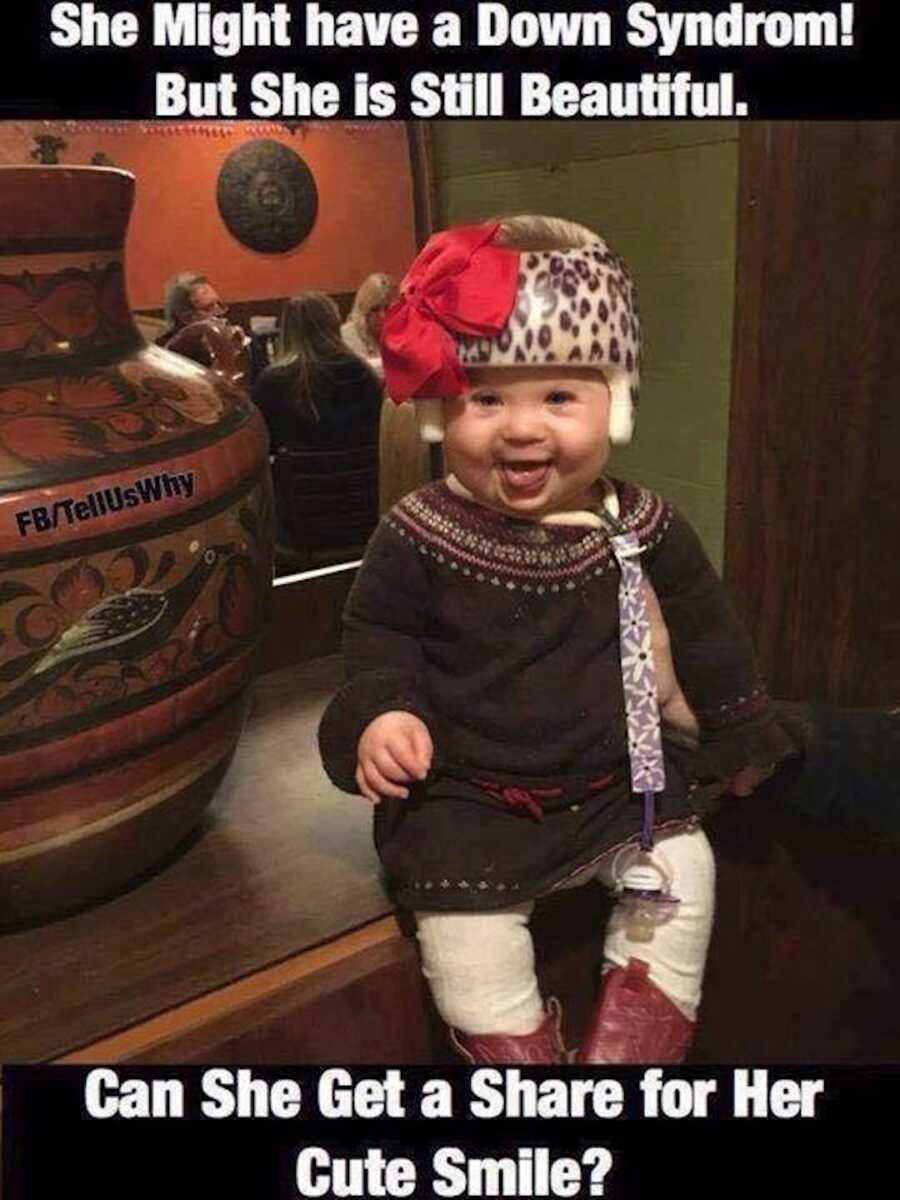 baby with down syndrome sits on dresser, social media post comments on beauty of baby