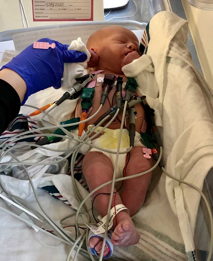 Adoptive newborn receiving treatment through tubes in hospital