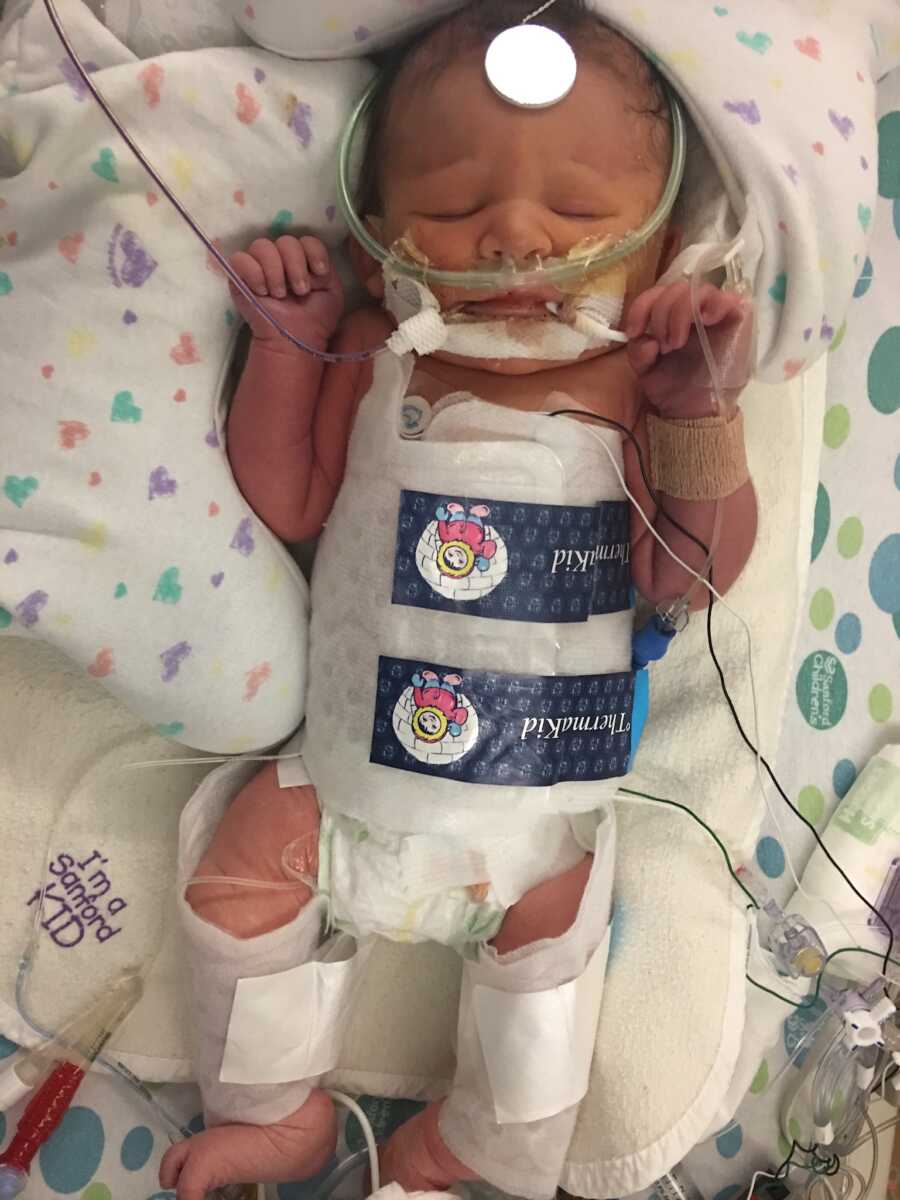 new born special needs daughter in NICU connected to tubes