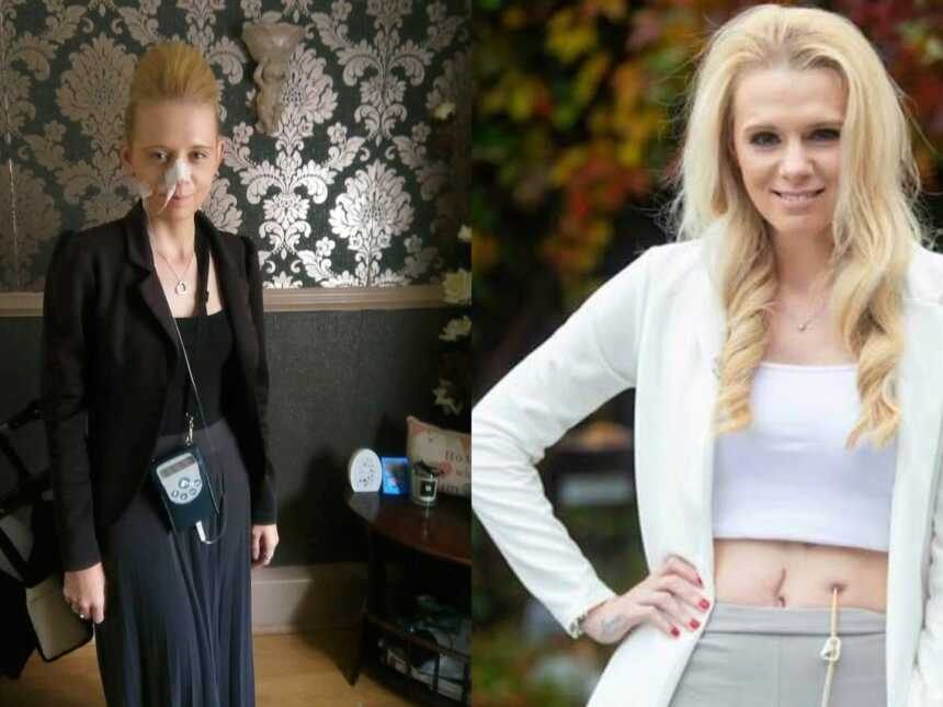 woman with chronic illness at low point and at a point when she is feeling better