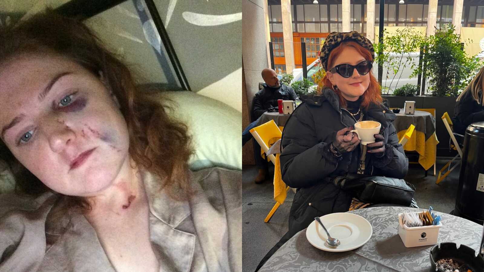 woman before and after becoming sober