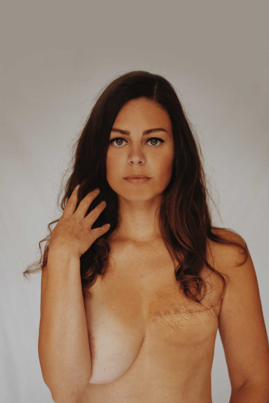 Brunette woman showing mastectomy scar