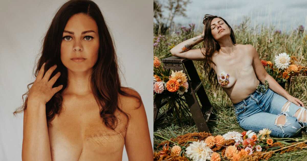 I Got Breast Cancer Young, With No Family History—Here’s My Story