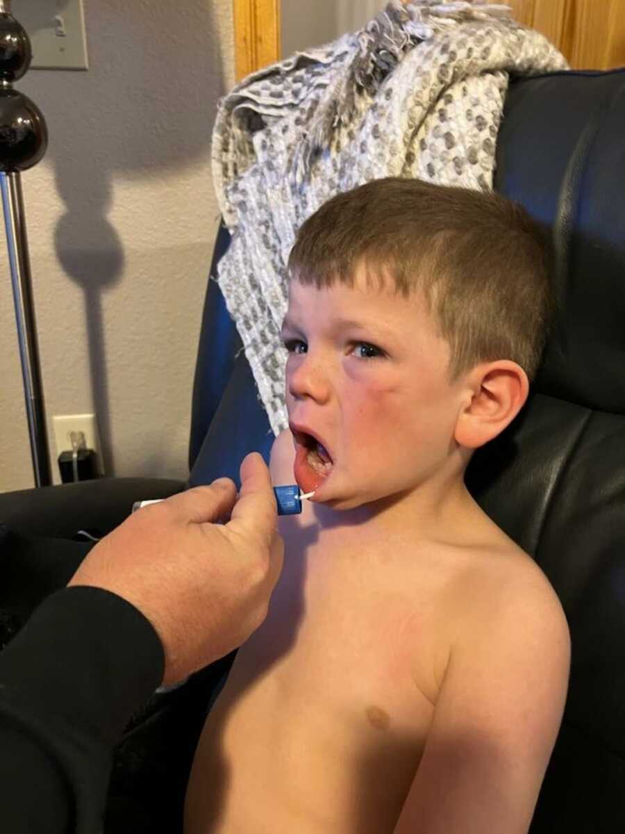 boy getting a Buccal swab to determine type of Sanfilippo Syndrome